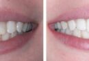 How to Choose the Best Dentist in Loganville for You and Your Family