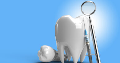 Brighten Your Smile with Teeth Whitening in Phoenix, AZ