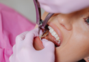 Dental Implants in Loganville: A Permanent Solution for a Confident, Healthy Smile